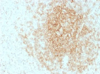 Immunohistochemistry (Formalin/PFA-fixed paraffin-embedded sections) - Anti-CD21 antibody [CR2/1953] (AB237981)