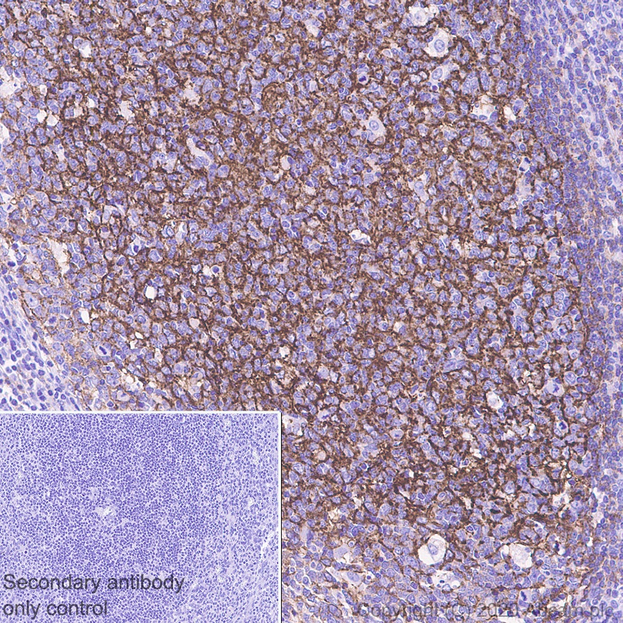 Immunohistochemistry (Formalin/PFA-fixed paraffin-embedded sections) - Anti-CD21 antibody [EP3093] (AB75985), expandable thumbnail