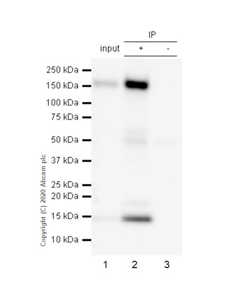 Immunoprecipitation - Anti-CD21 antibody [EP3093] (AB75985), expandable thumbnail