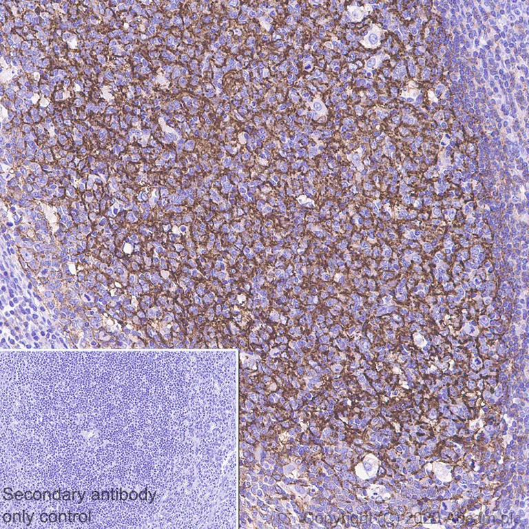 Immunohistochemistry (Formalin/PFA-fixed paraffin-embedded sections) - Anti-CD21 antibody [EP3093] - Low endotoxin, Azide free (AB193554)