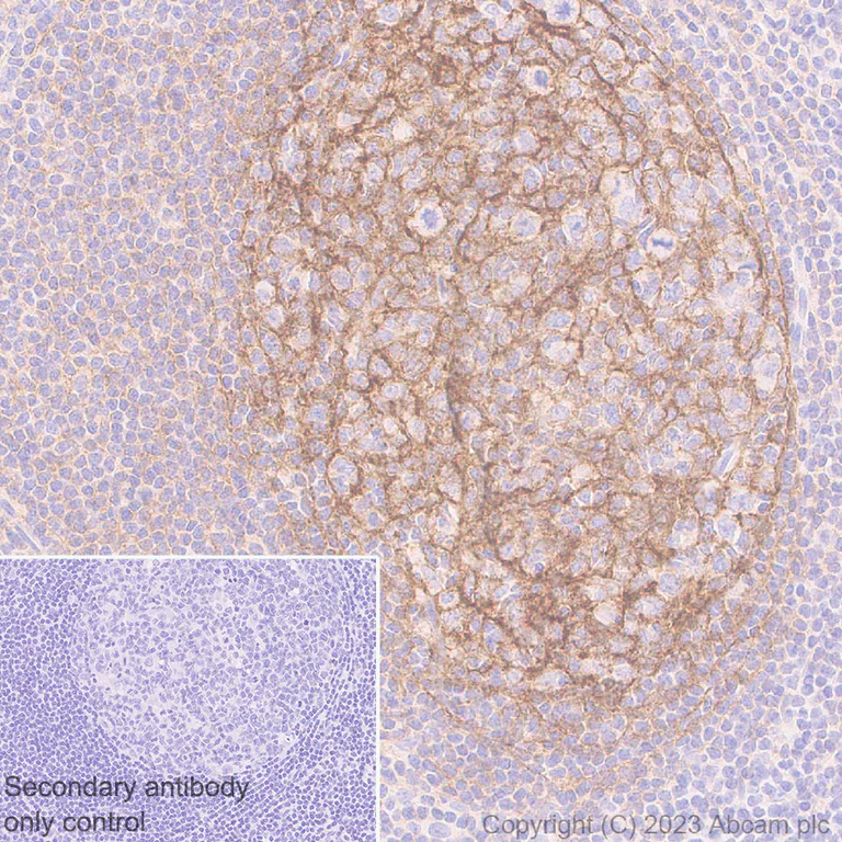Immunohistochemistry (Formalin/PFA-fixed paraffin-embedded sections) - Anti-CD21 antibody [EPR27369-9] (AB315160)