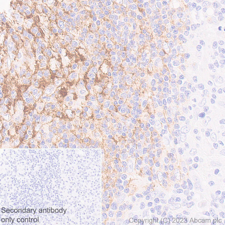 Immunohistochemistry (Formalin/PFA-fixed paraffin-embedded sections) - Anti-CD21 antibody [EPR27369-9] (AB315160)