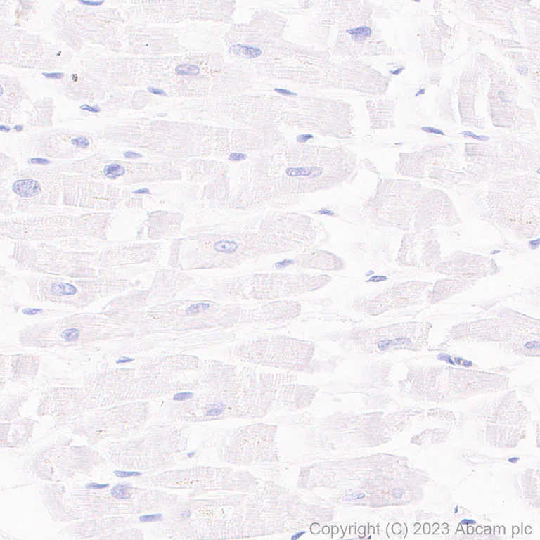 Immunohistochemistry (Formalin/PFA-fixed paraffin-embedded sections) - Anti-CD21 antibody [EPR27369-9] (AB315160)