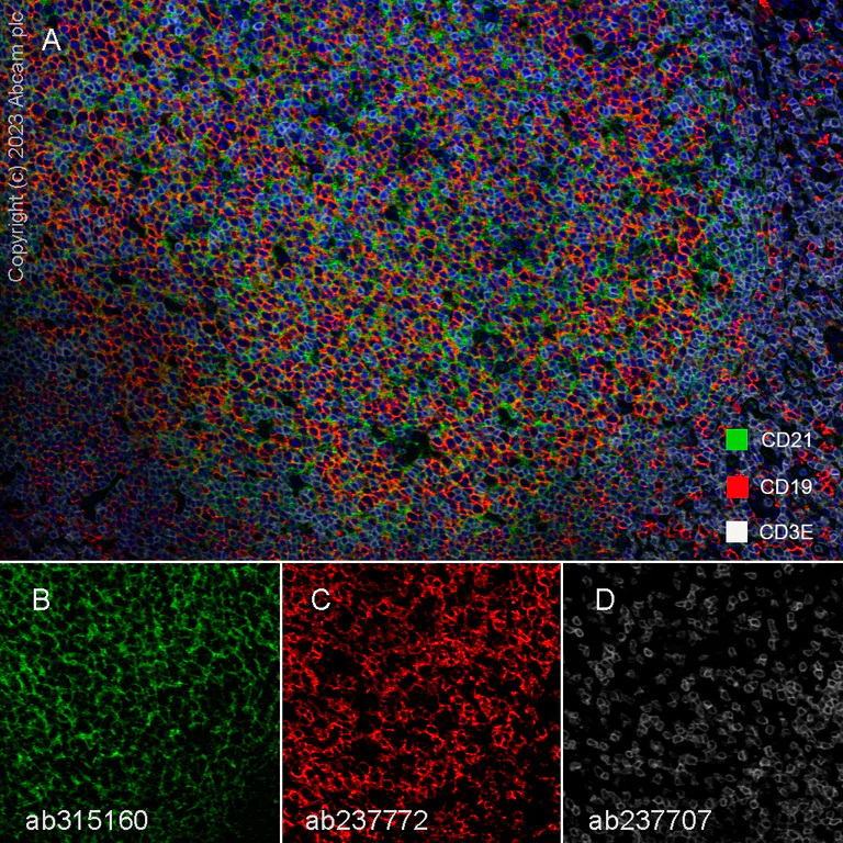 Multiplex immunohistochemistry - Anti-CD21 antibody [EPR27369-9] (AB315160)