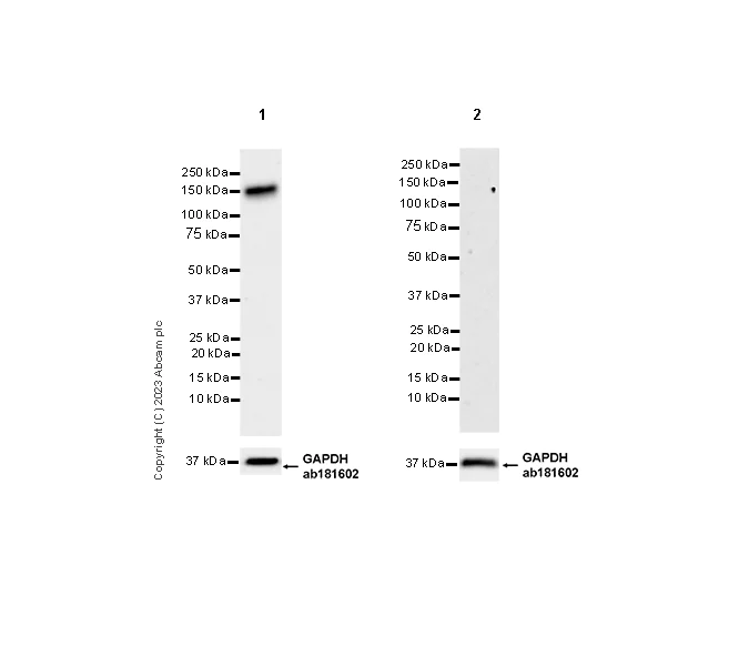 Western blot - Anti-CD21 antibody [EPR27369-9] (AB315160)