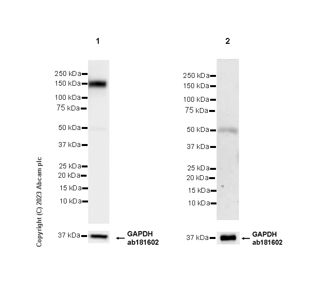 Western blot - Anti-CD21 antibody [EPR27369-9] (AB315160)