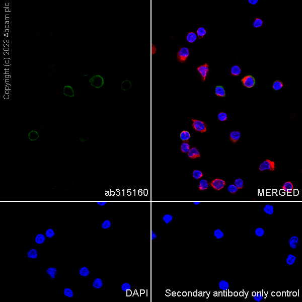 Immunocytochemistry/ Immunofluorescence - Anti-CD21 antibody [EPR27369-9] - BSA and Azide free (ab315161), expandable thumbnail