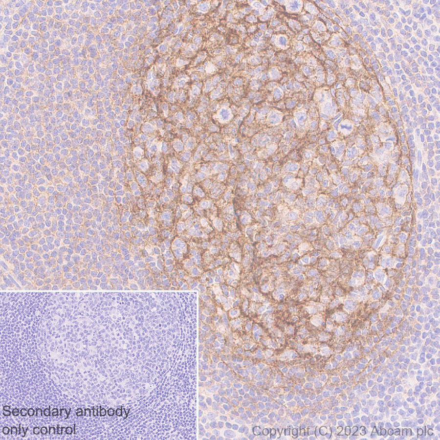 Immunohistochemistry (Formalin/PFA-fixed paraffin-embedded sections) - Anti-CD21 antibody [EPR27369-9] - BSA and Azide free (ab315161), expandable thumbnail