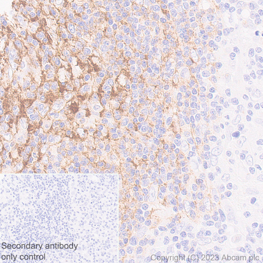 Immunohistochemistry (Formalin/PFA-fixed paraffin-embedded sections) - Anti-CD21 antibody [EPR27369-9] - BSA and Azide free (ab315161), expandable thumbnail