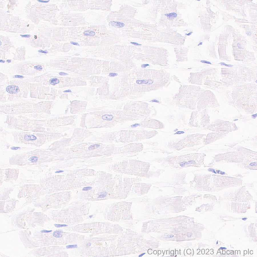 Immunohistochemistry (Formalin/PFA-fixed paraffin-embedded sections) - Anti-CD21 antibody [EPR27369-9] - BSA and Azide free (ab315161), expandable thumbnail