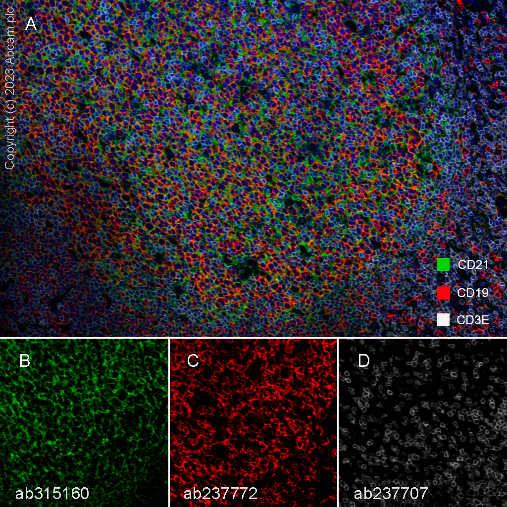Multiplex immunohistochemistry - Anti-CD21 antibody [EPR27369-9] - BSA and Azide free (AB315161), expandable thumbnail
