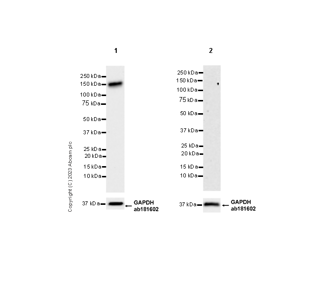Western blot - Anti-CD21 antibody [EPR27369-9] - BSA and Azide free (ab315161), expandable thumbnail