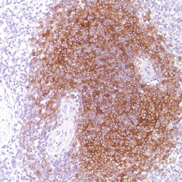 Immunohistochemistry (Formalin/PFA-fixed paraffin-embedded sections) - Anti-CD21 antibody [SP186] - BSA and Azide free (AB240987)