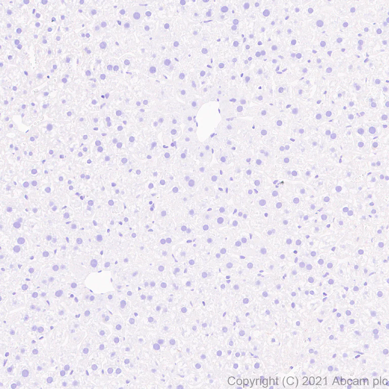 Immunohistochemistry (Formalin/PFA-fixed paraffin-embedded sections) - Anti-CD21 antibody [SP186] - BSA and Azide free (AB240987)