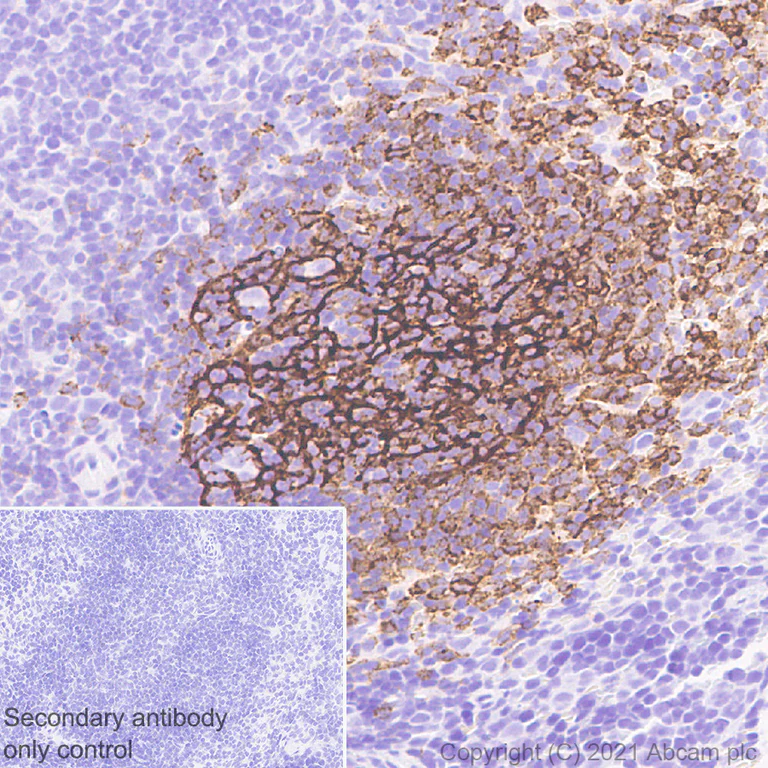 Immunohistochemistry (Formalin/PFA-fixed paraffin-embedded sections) - Anti-CD21 antibody [SP186] - BSA and Azide free (AB240987)