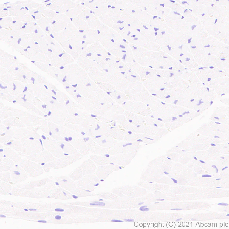 Immunohistochemistry (Formalin/PFA-fixed paraffin-embedded sections) - Anti-CD21 antibody [SP186] - BSA and Azide free (AB240987)