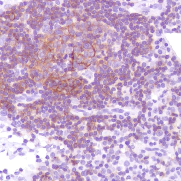 Immunohistochemistry (Formalin/PFA-fixed paraffin-embedded sections) - Anti-CD21 antibody [SP186] - BSA and Azide free (AB240987)