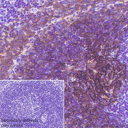 Immunohistochemistry (Formalin/PFA-fixed paraffin-embedded sections) - Anti-CD21 antibody [SP186] - BSA and Azide free (AB240987)