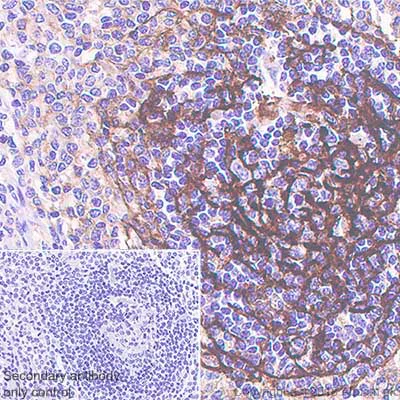 Immunohistochemistry (Formalin/PFA-fixed paraffin-embedded sections) - Anti-CD21 antibody [SP186] - BSA and Azide free (AB240987)