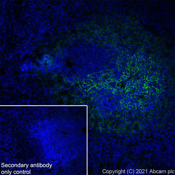 Immunohistochemistry (Frozen sections) - Anti-CD21 antibody [SP186] - BSA and Azide free (AB240987)