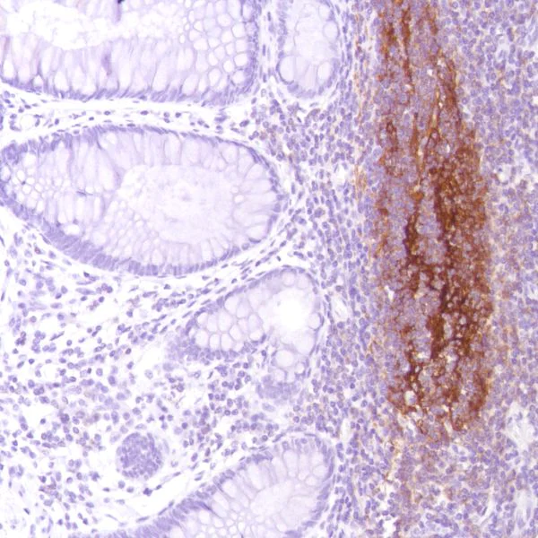 Immunohistochemistry (Formalin/PFA-fixed paraffin-embedded sections) - Anti-CD21 antibody [SP186] - C-terminal (AB227662)