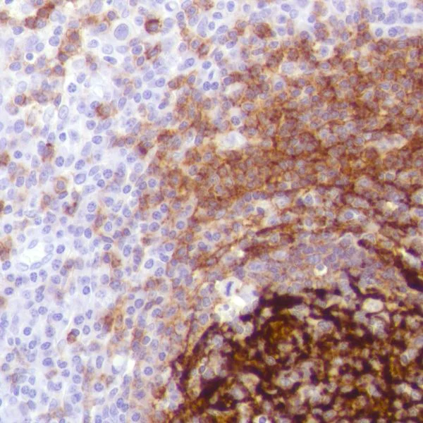 Immunohistochemistry (Formalin/PFA-fixed paraffin-embedded sections) - Anti-CD21 antibody [SP186] - C-terminal (AB227662)