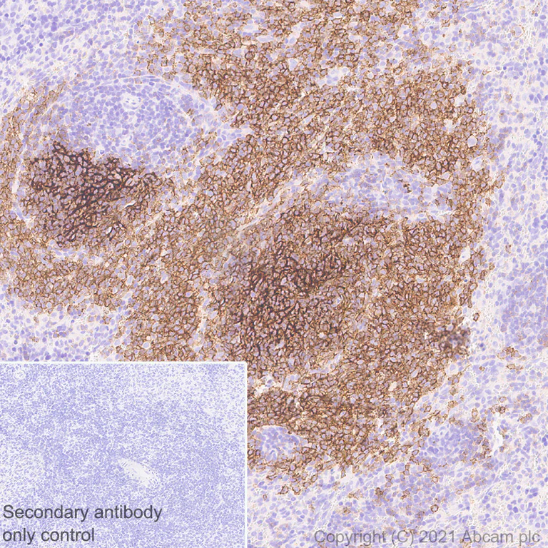 Immunohistochemistry (Formalin/PFA-fixed paraffin-embedded sections) - Anti-CD21 antibody [SP186] - C-terminal (AB227662)