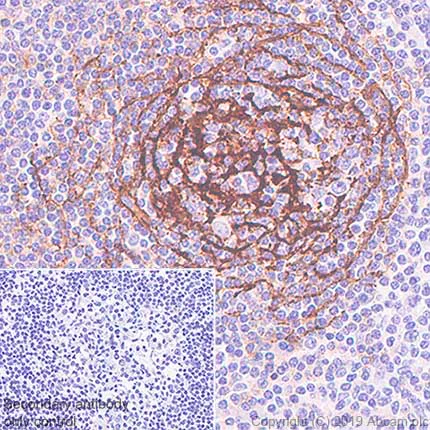 Anti-CD21 antibody [SP186] - C-terminal (ab227662) | Abcam
