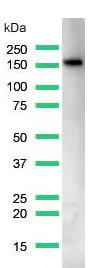 Western blot - Anti-CD21 antibody [SP199] (AB227668)