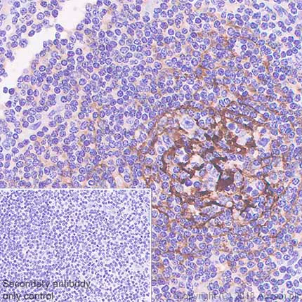 Immunohistochemistry (Formalin/PFA-fixed paraffin-embedded sections) - Anti-CD21 antibody [SP199] - BSA and Azide free (AB240988)
