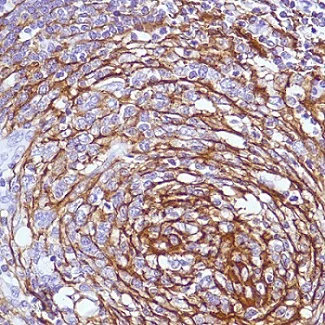 Immunohistochemistry (Formalin/PFA-fixed paraffin-embedded sections) - Anti-CD21 antibody [SP199] - BSA and Azide free (AB240988)
