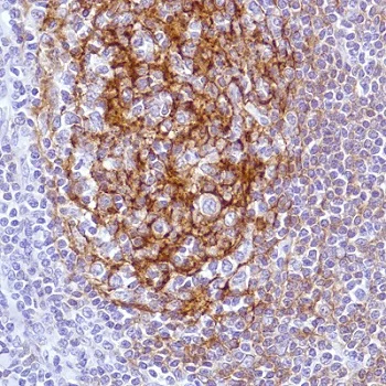 Immunohistochemistry (Formalin/PFA-fixed paraffin-embedded sections) - Anti-CD21 antibody [SP199] - BSA and Azide free (AB240988)