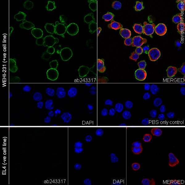 Immunocytochemistry/ Immunofluorescence - Anti-CD21+CD35 antibody [4B2] (AB243317), expandable thumbnail