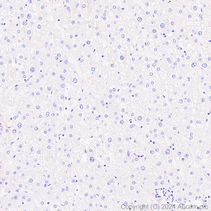 Immunohistochemistry (Formalin/PFA-fixed paraffin-embedded sections) - Anti-CD21+CD35 antibody [EPR27417-508] (AB317494), expandable thumbnail