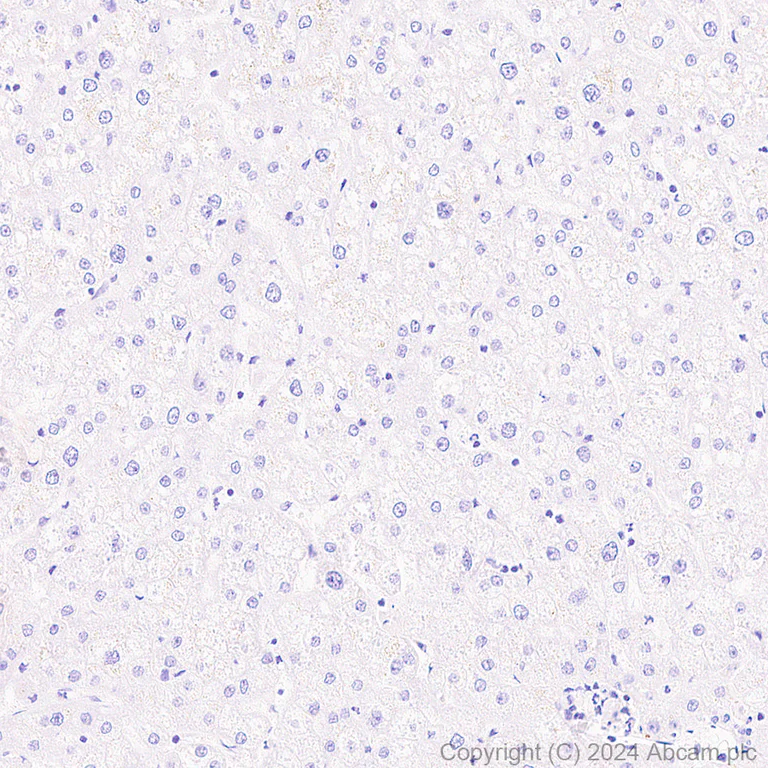 Immunohistochemistry (Formalin/PFA-fixed paraffin-embedded sections) - Anti-CD21+CD35 antibody [EPR27417-508] (AB317494)