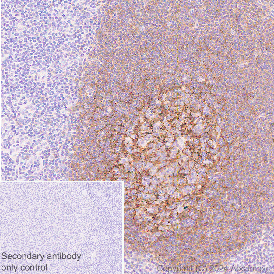 Immunohistochemistry (Formalin/PFA-fixed paraffin-embedded sections) - Anti-CD21+CD35 antibody [EPR27417-508] (ab317494), expandable thumbnail
