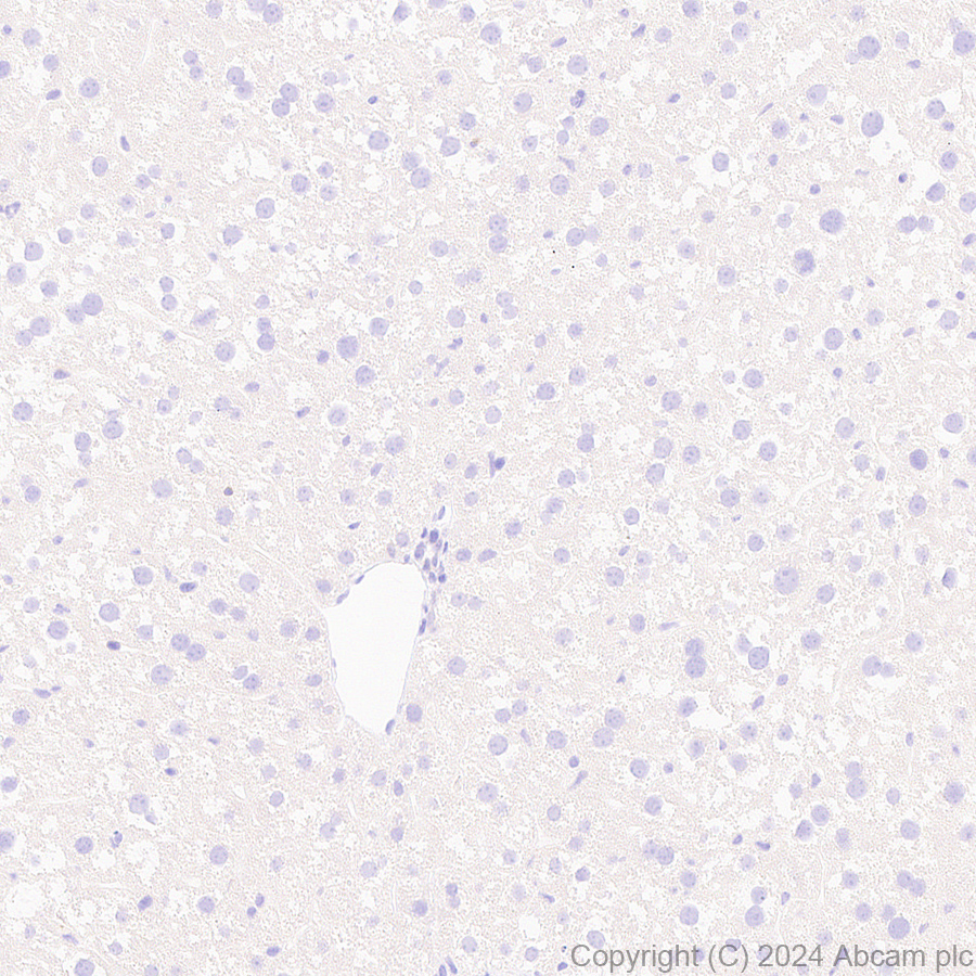 Immunohistochemistry (Formalin/PFA-fixed paraffin-embedded sections) - Anti-CD21+CD35 antibody [EPR27417-508] (AB317494), expandable thumbnail