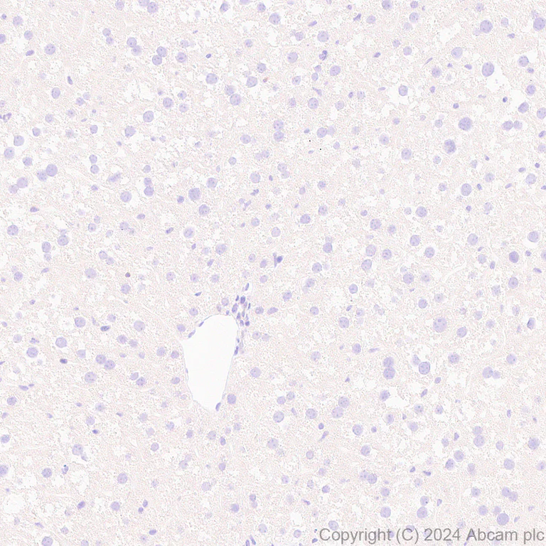 Immunohistochemistry (Formalin/PFA-fixed paraffin-embedded sections) - Anti-CD21+CD35 antibody [EPR27417-508] (AB317494)