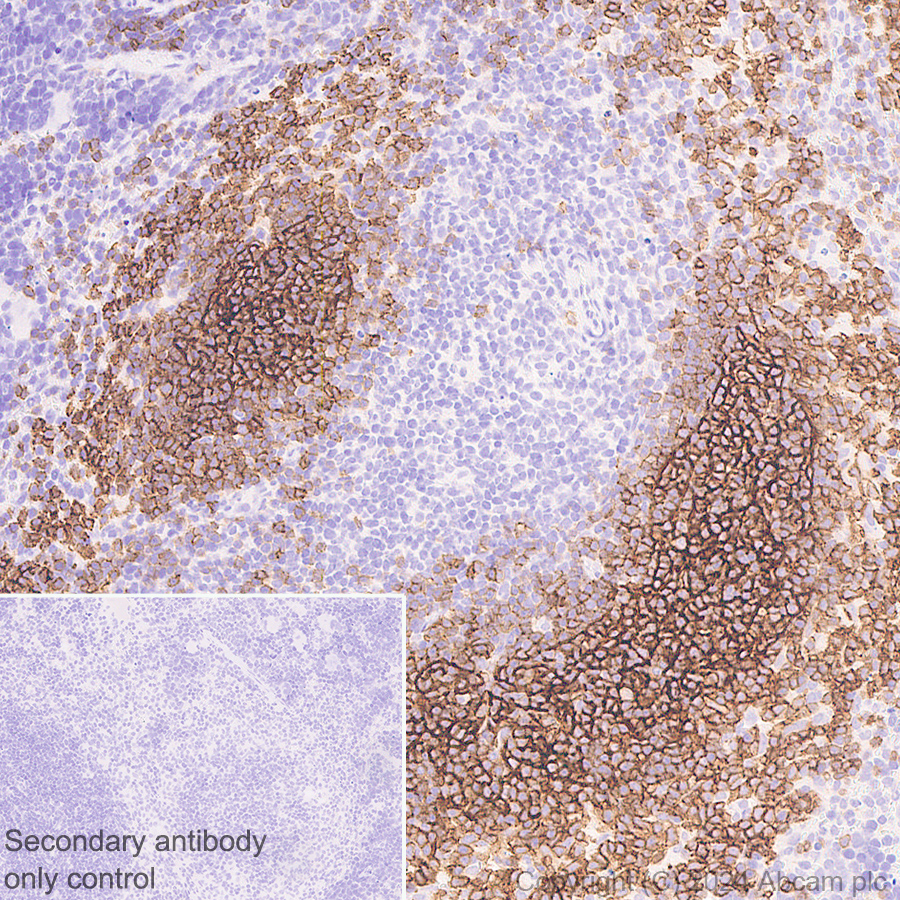 Immunohistochemistry (Formalin/PFA-fixed paraffin-embedded sections) - Anti-CD21+CD35 antibody [EPR27417-508] (AB317494), expandable thumbnail