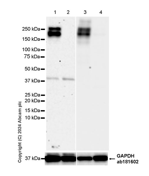 Western blot - Anti-CD21+CD35 antibody [EPR27417-508] (AB317494), expandable thumbnail