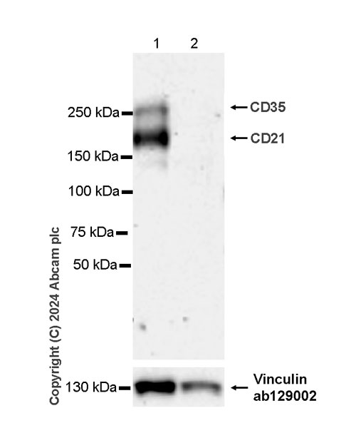 Western blot - Anti-CD21+CD35 antibody [EPR27417-508] (AB317494), expandable thumbnail