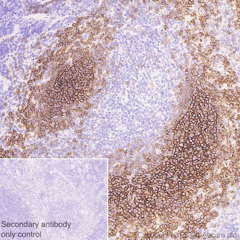 Immunohistochemistry (Formalin/PFA-fixed paraffin-embedded sections) - Anti-CD21+CD35 antibody [EPR27417-508] - BSA and Azide free (AB317495)