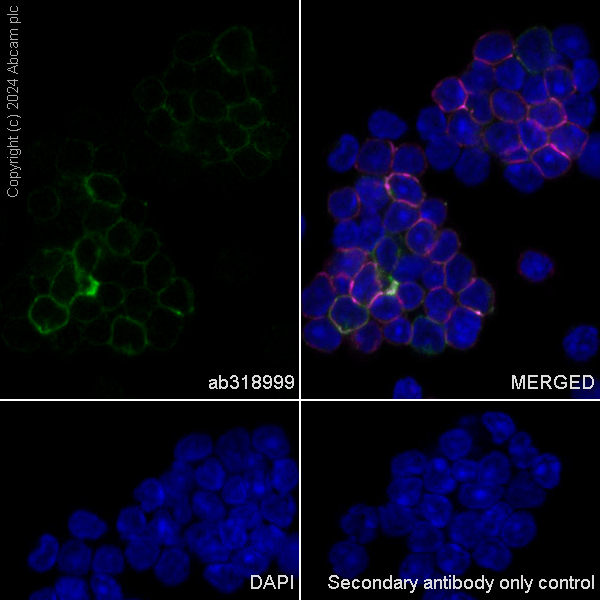 Immunocytochemistry/ Immunofluorescence - Anti-CD21+CD35 antibody [RM2062] (AB318999), expandable thumbnail