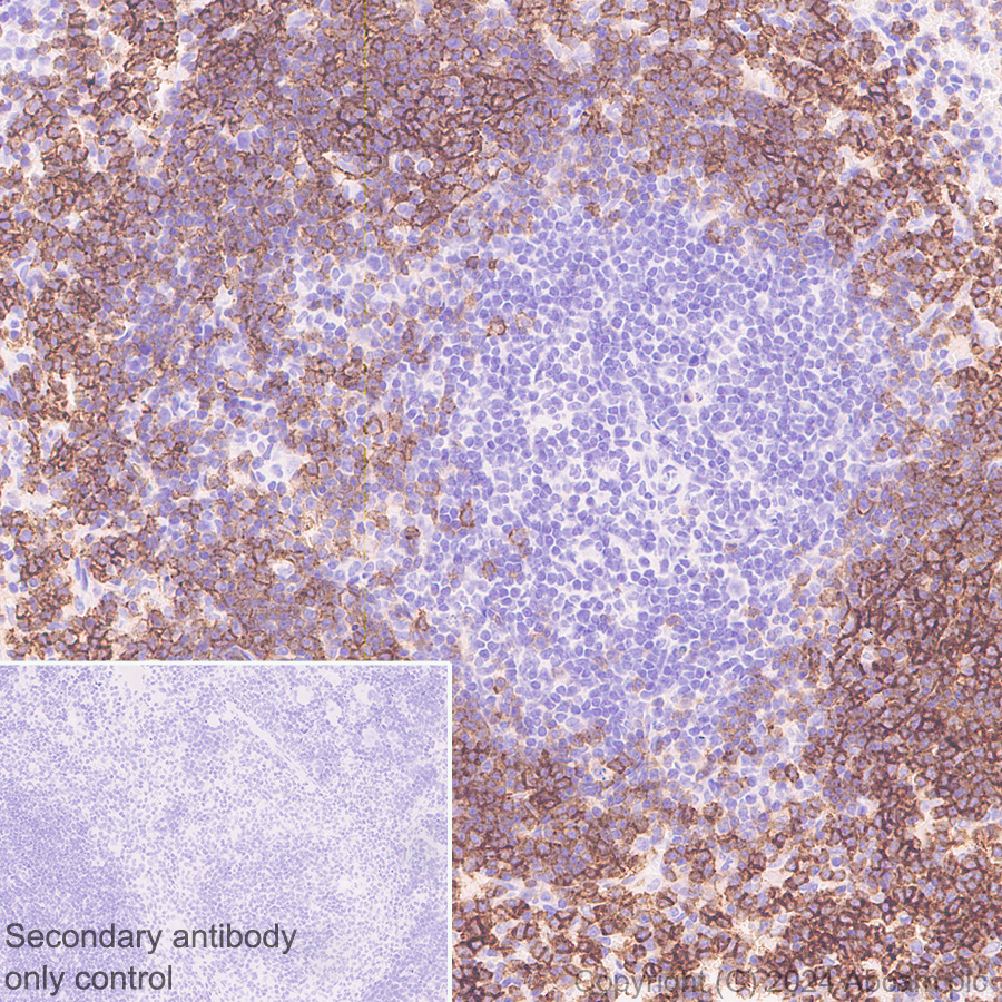 Immunohistochemistry (Formalin/PFA-fixed paraffin-embedded sections) - Anti-CD21+CD35 antibody [RM2062] (ab318999), expandable thumbnail