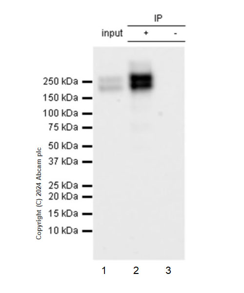 Immunoprecipitation - Anti-CD21+CD35 antibody [RM2062] (AB318999), expandable thumbnail