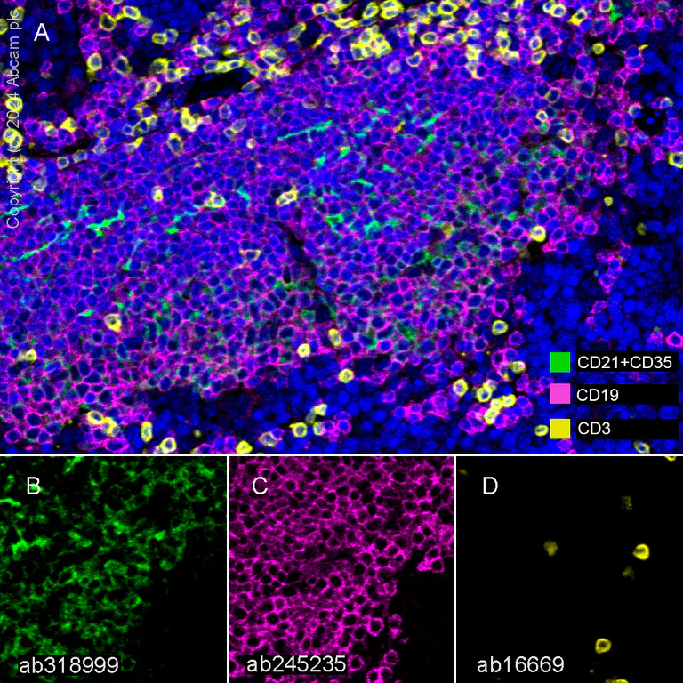 Multiplex immunohistochemistry - Anti-CD21+CD35 antibody [RM2062] (AB318999)