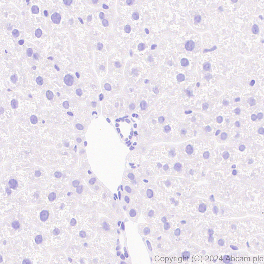Immunohistochemistry (Formalin/PFA-fixed paraffin-embedded sections) - Anti-CD21+CD35 antibody [RM2062] - BSA and Azide free (AB319000)