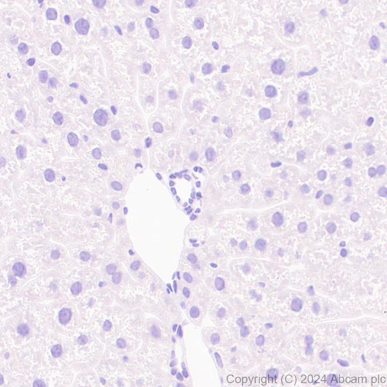 Immunohistochemistry (Formalin/PFA-fixed paraffin-embedded sections) - Anti-CD21+CD35 antibody [RM2062] - BSA and Azide free (AB319000)
