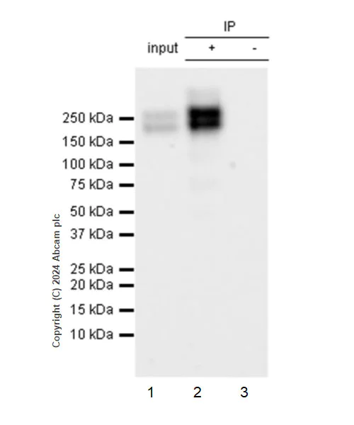 Immunoprecipitation - Anti-CD21+CD35 antibody [RM2062] - BSA and Azide free (AB319000)
