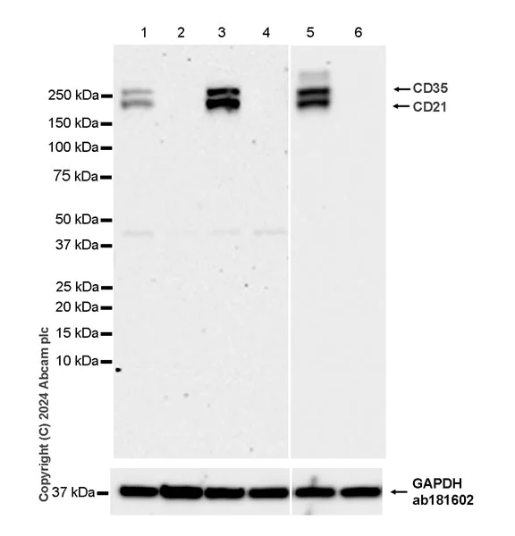 Western blot - Anti-CD21+CD35 antibody [RM2062] - BSA and Azide free (AB319000)